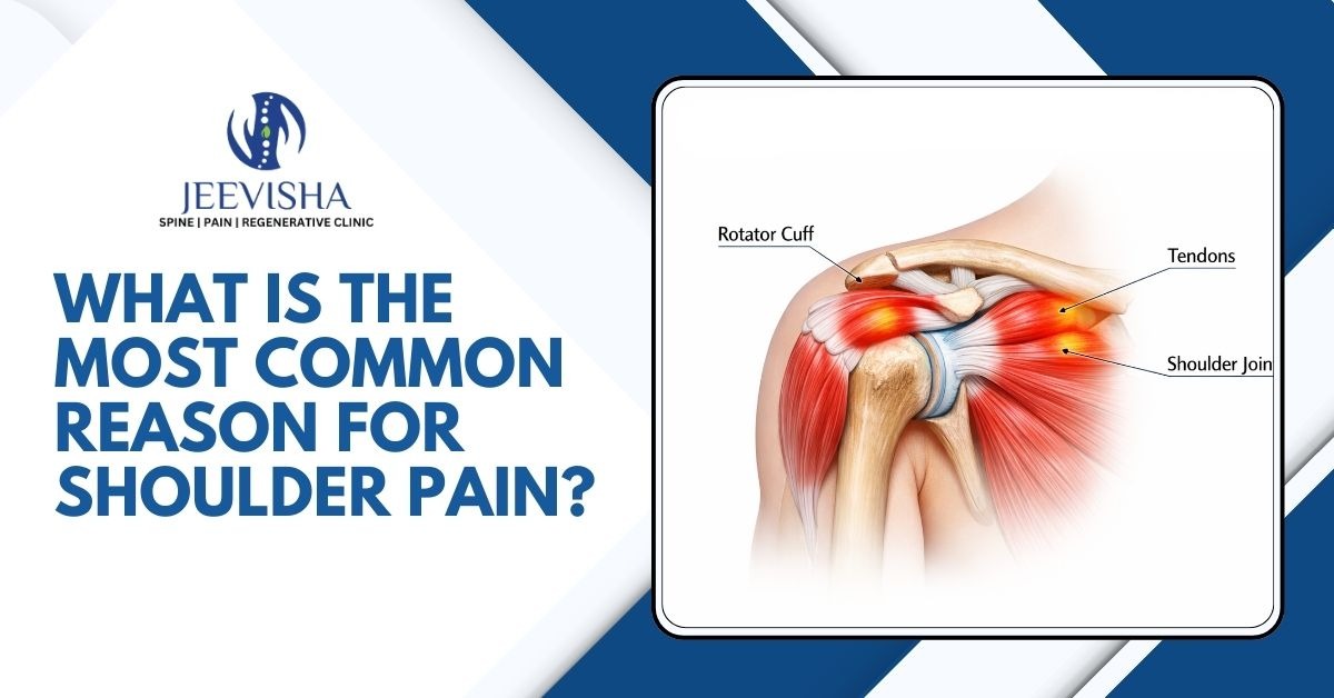 What Is The Most Common Reason For Shoulder Pain?