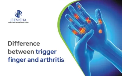 Difference between trigger finger and arthritis