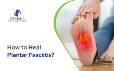 How to Heal Plantar Fasciitis?