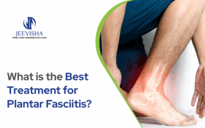 What is the Best Treatment for Plantar Fasciitis?