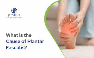 What is the Cause of Plantar Fasciitis?