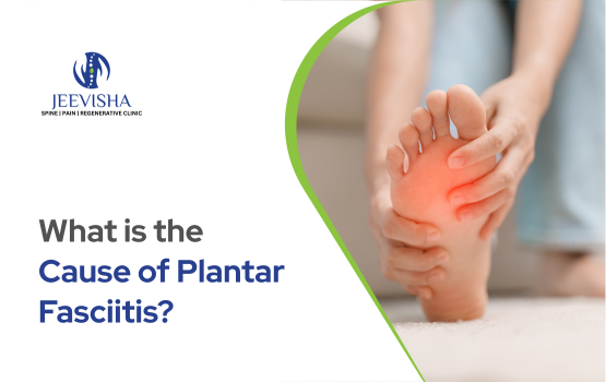 What is the Cause of Plantar Fasciitis What is the Cause of Plantar Fasciitis